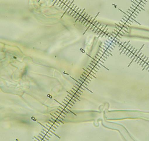 Amphinema byssoides? (Amphinema byssoides)